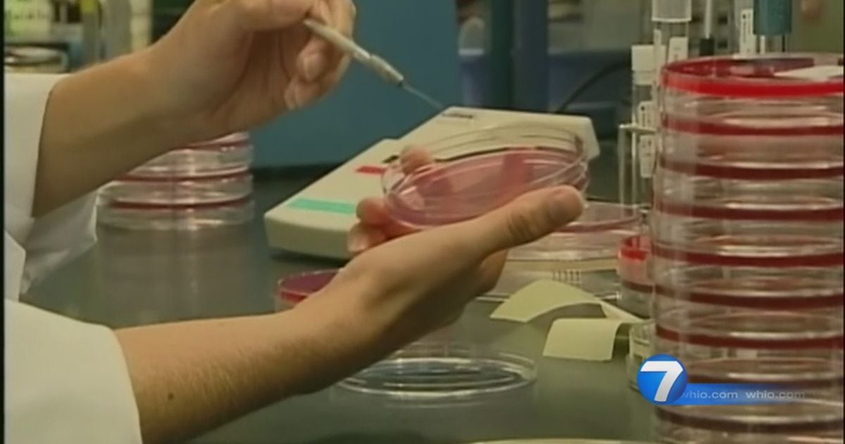CDC reports E. coli outbreak, includes Ohio case