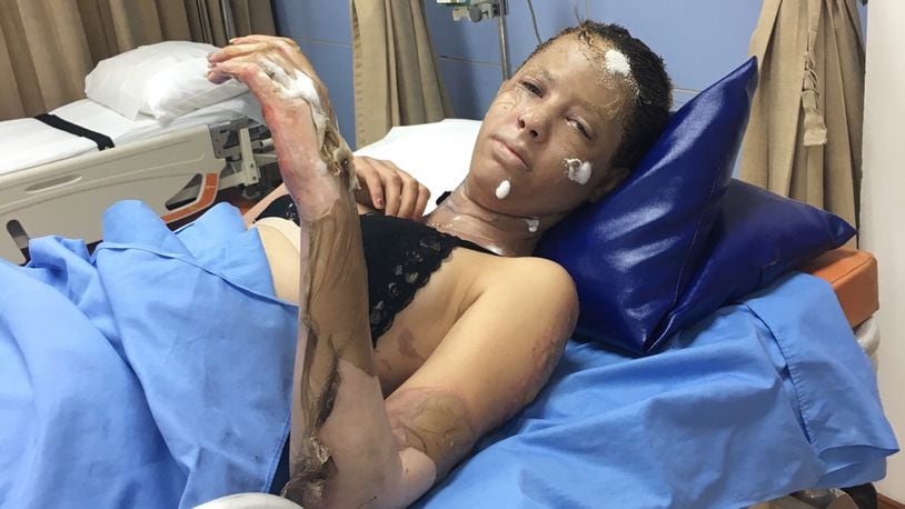 Abigail Alexander is being treated in hospital in Cambodia after she and a British teacher were victims in the blast that injured 13 people in Siem Reap, according to multiple reports. CONTRIBUTED